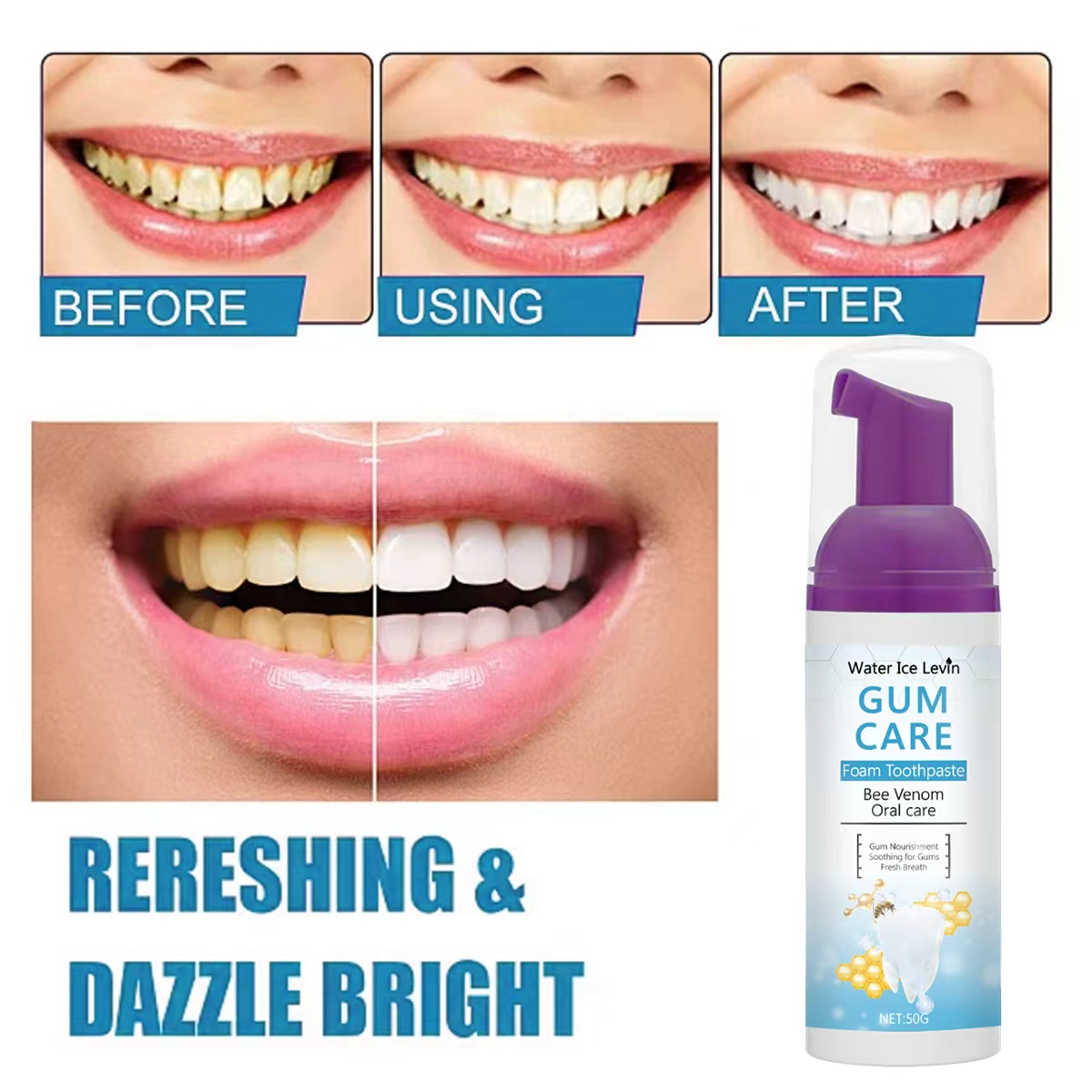 Water Ice Levin Gum Care Foam  - Teeth Whitening Xylitol 리뷰 및 가격