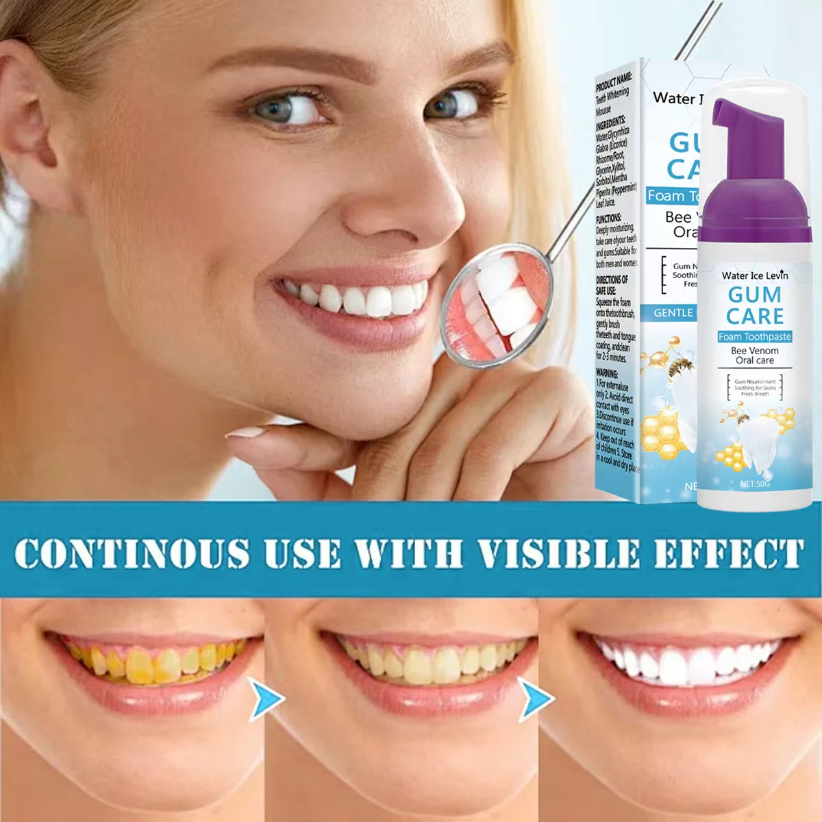 Water Ice Levin Gum Care Foam  - Teeth Whitening Xylitol 리뷰 및 가격