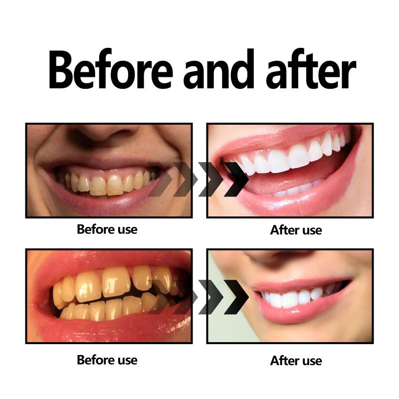 Teeth Whitening Powder Charcoa - Teeth Whitening Baking Soda 리뷰 및 가격