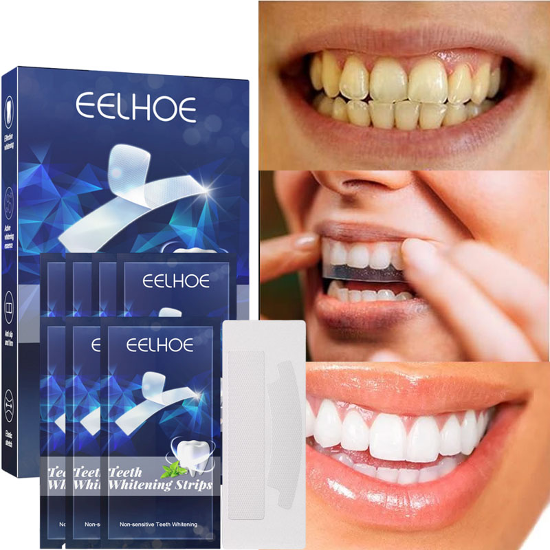 Teeth Whitening Stickers Mint  - Teeth Whitening Gel Refills 리뷰 및 가격
