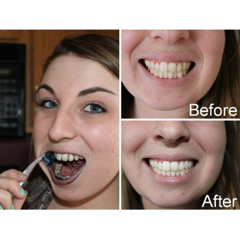 Bamboo Charcoal Teeth Tooth De - Teeth Whitening Flash 리뷰 및 가격