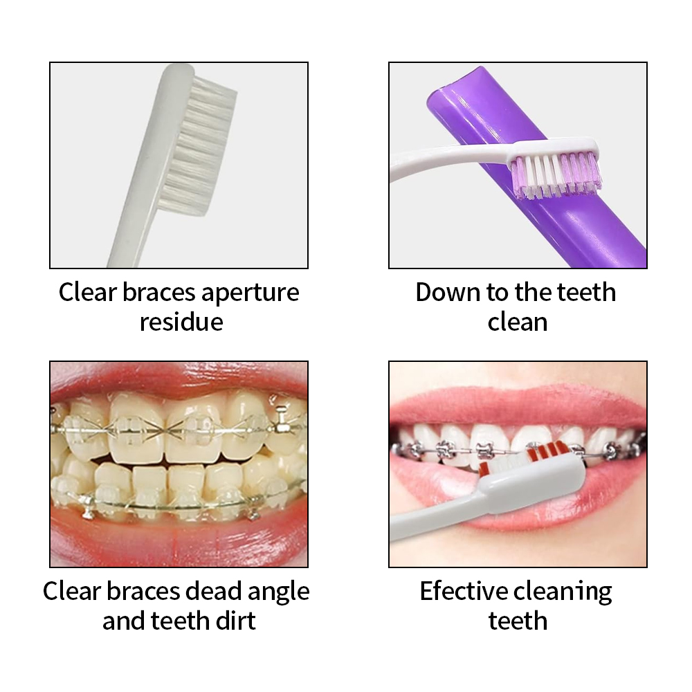 8Pcs/set Orthodontic Dental Ca - Teeth Whitening With Braces 리뷰 및 가격