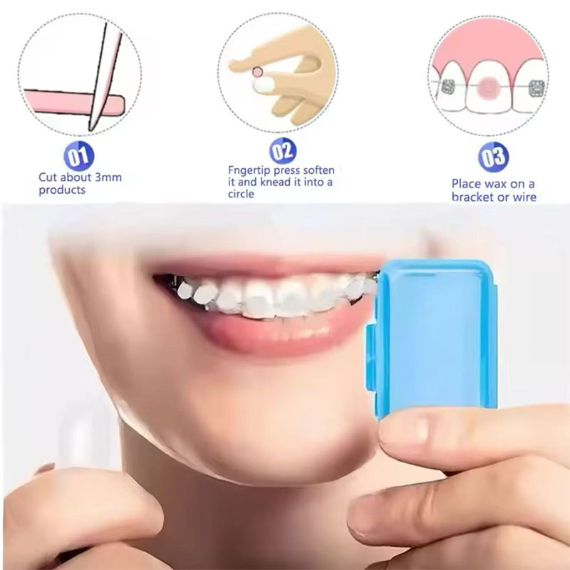 1set Orthodontic Dental Oral C - Teeth Whitening With Braces 리뷰 및 가격