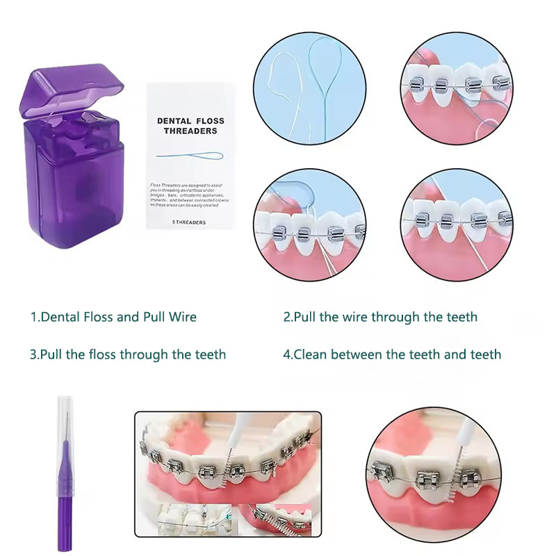1set Orthodontic Dental Oral C - Teeth Whitening With Braces 리뷰 및 가격