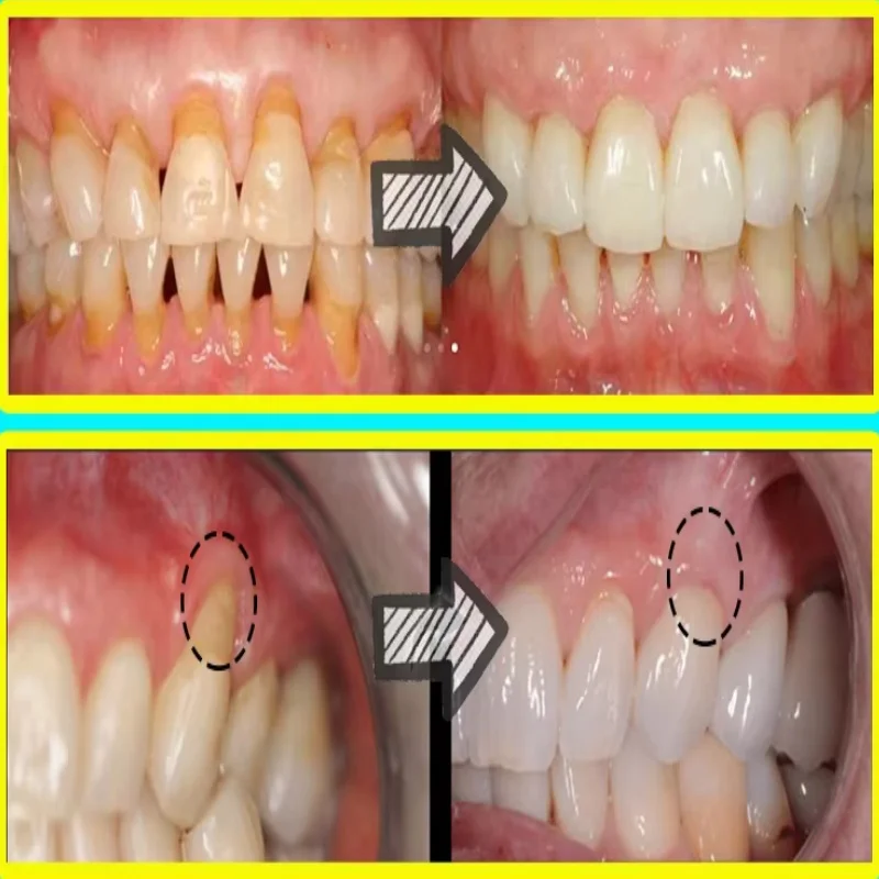Quickly Repair Gum Serum Relie - Teeth Whitening Baking Soda 리뷰 및 가격