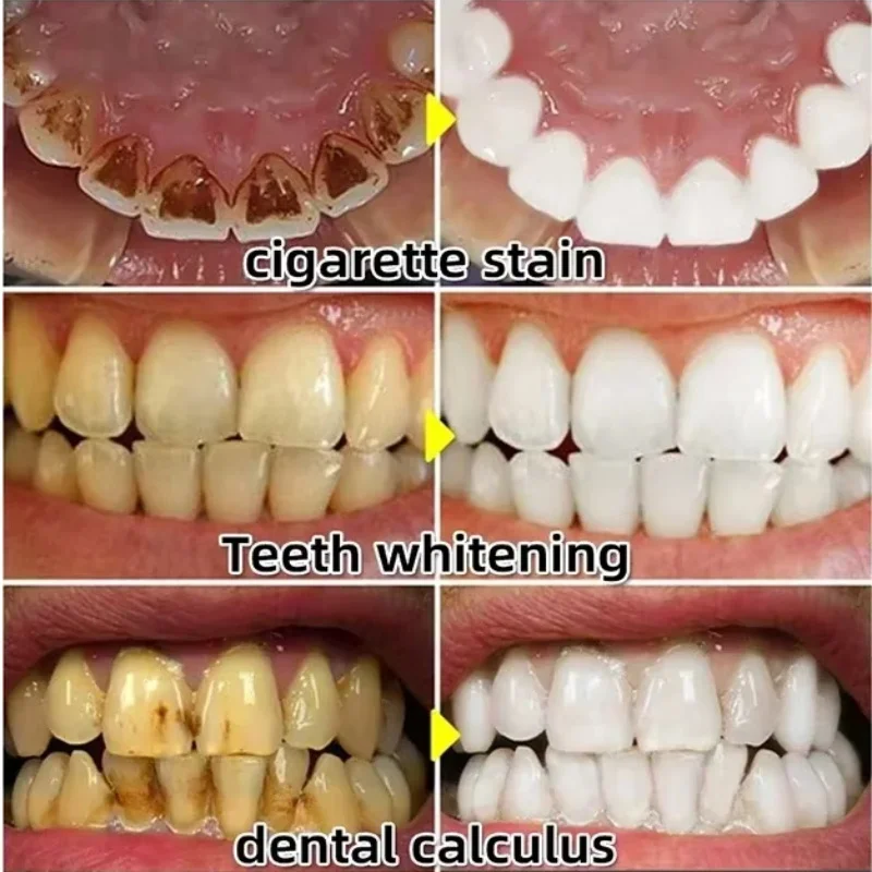 Quickly Repair Gum Serum Relie - Teeth Whitening Baking Soda 리뷰 및 가격