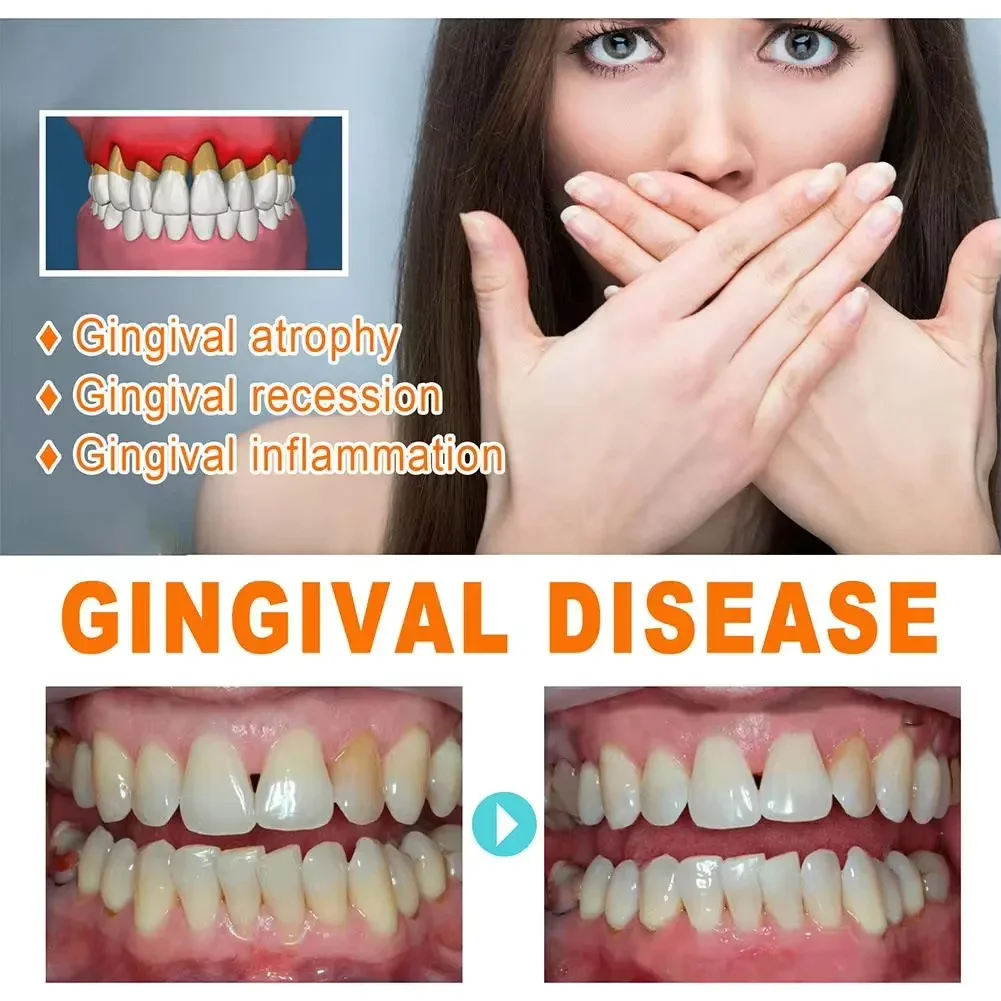 Quickly Repair Gum Serum Relie - Teeth Whitening Baking Soda 리뷰 및 가격