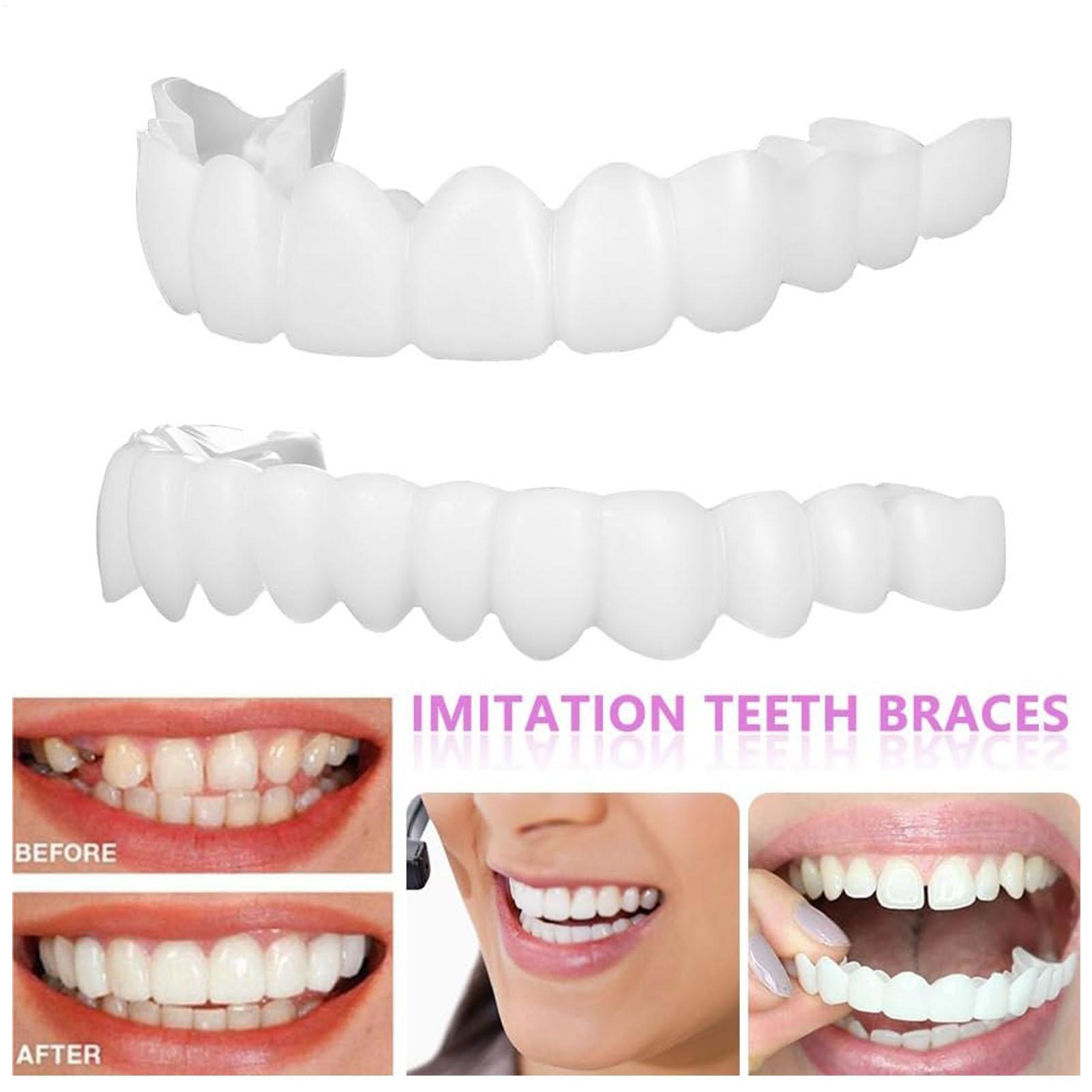 Dental Upper Lower Fake Teeth  - Teeth Whitening With Braces 리뷰 및 가격