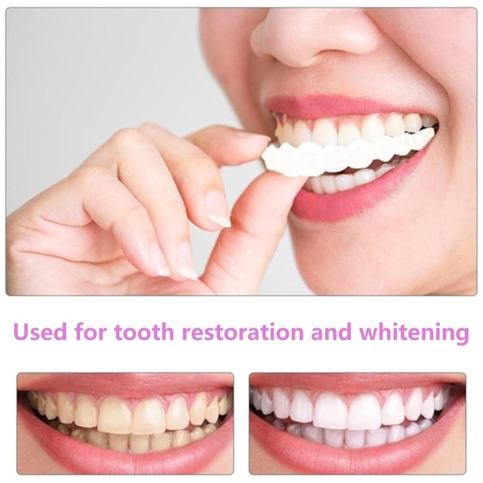 Dental Upper Lower Fake Teeth  - Teeth Whitening With Braces 리뷰 및 가격