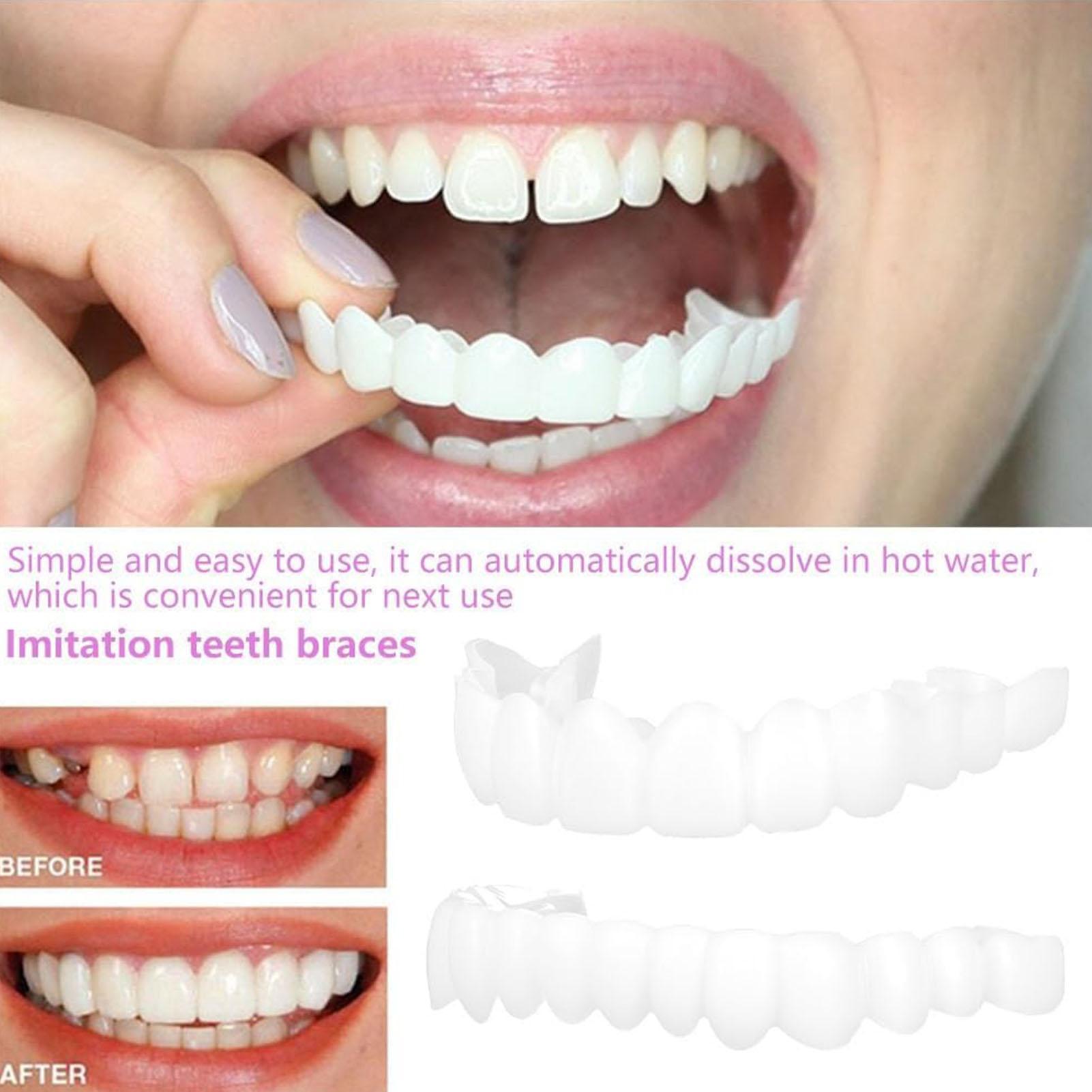 Dental Upper Lower Fake Teeth  - Teeth Whitening With Braces 리뷰 및 가격
