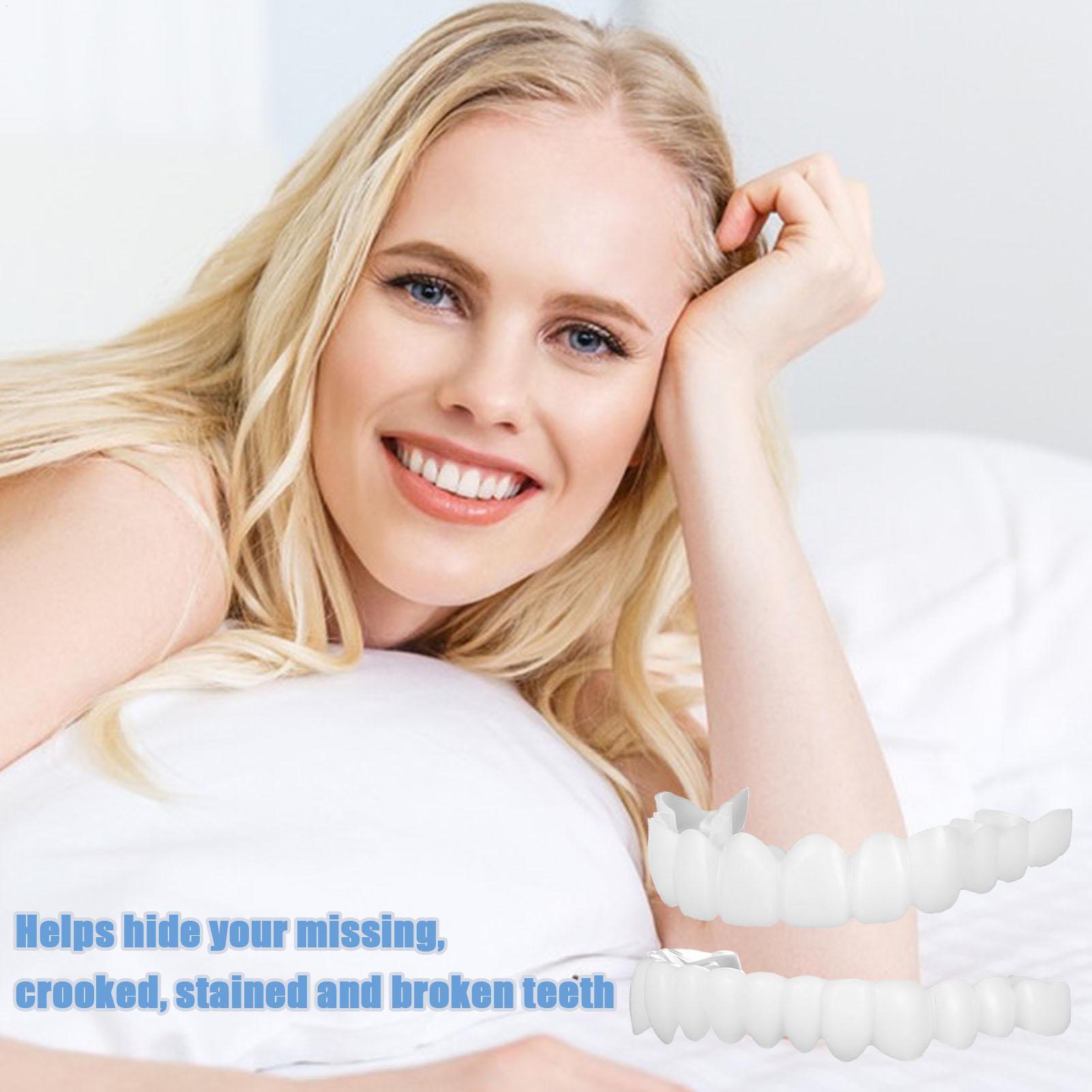 Dental Upper Lower Fake Teeth  - Teeth Whitening With Braces 리뷰 및 가격