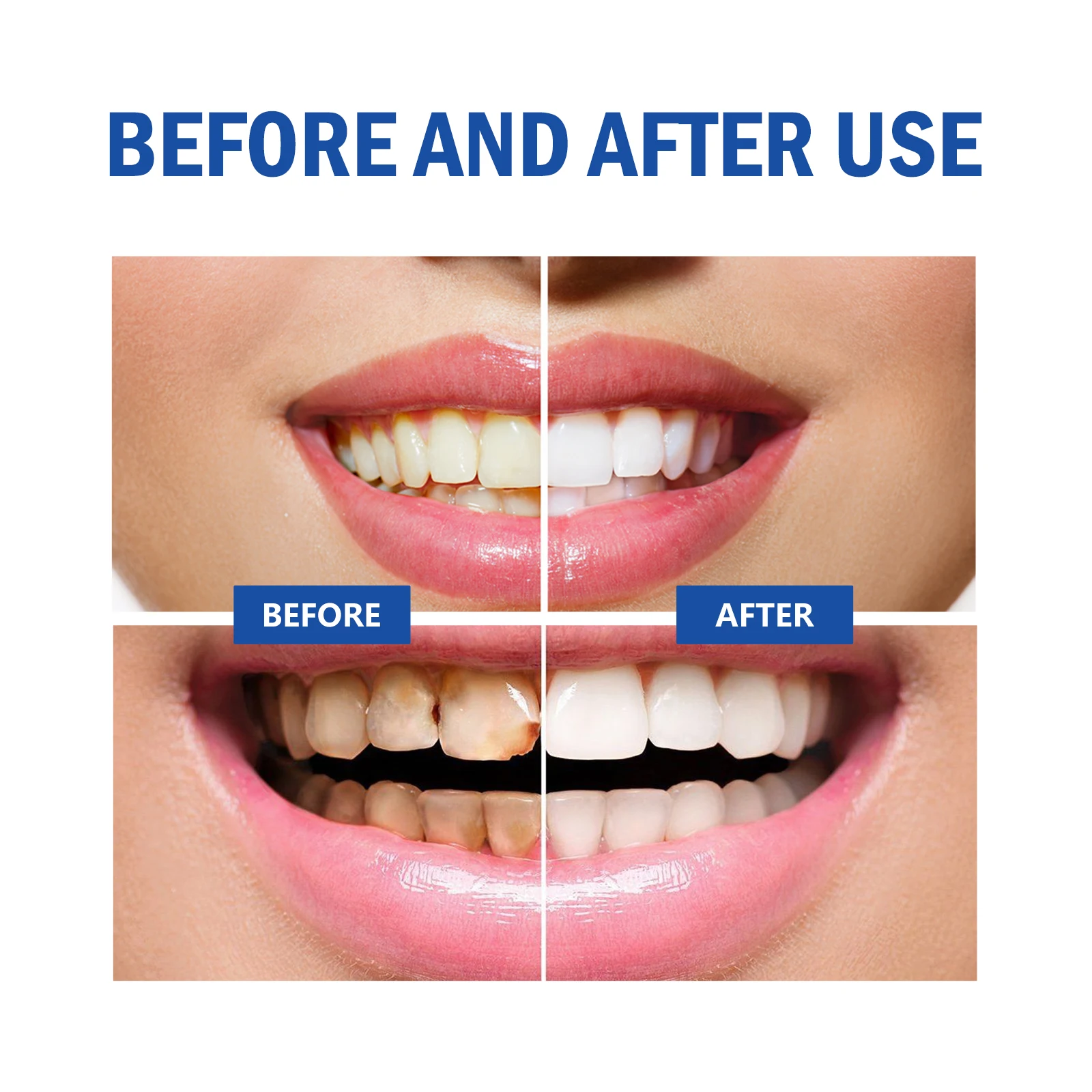 2pcs Gum Repair Gel Spray Deep - Teeth Whitening Xylitol 리뷰 및 가격