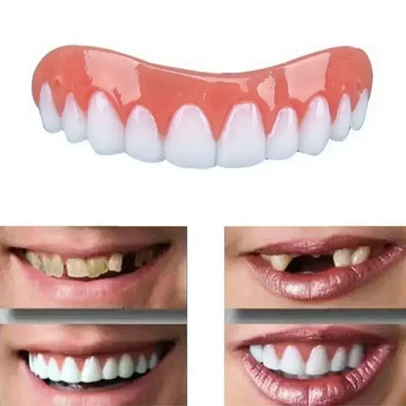 New False Teeth Silicone Upper - Teeth Whitening With Braces 리뷰 및 가격
