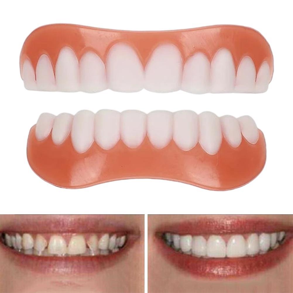 New False Teeth Silicone Upper - Teeth Whitening With Braces 리뷰 및 가격