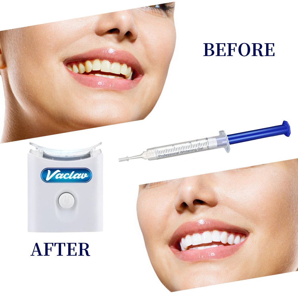 Mint Teeth Whitening Gel Syrin - Teeth Whitening Baking Soda 리뷰 및 가격