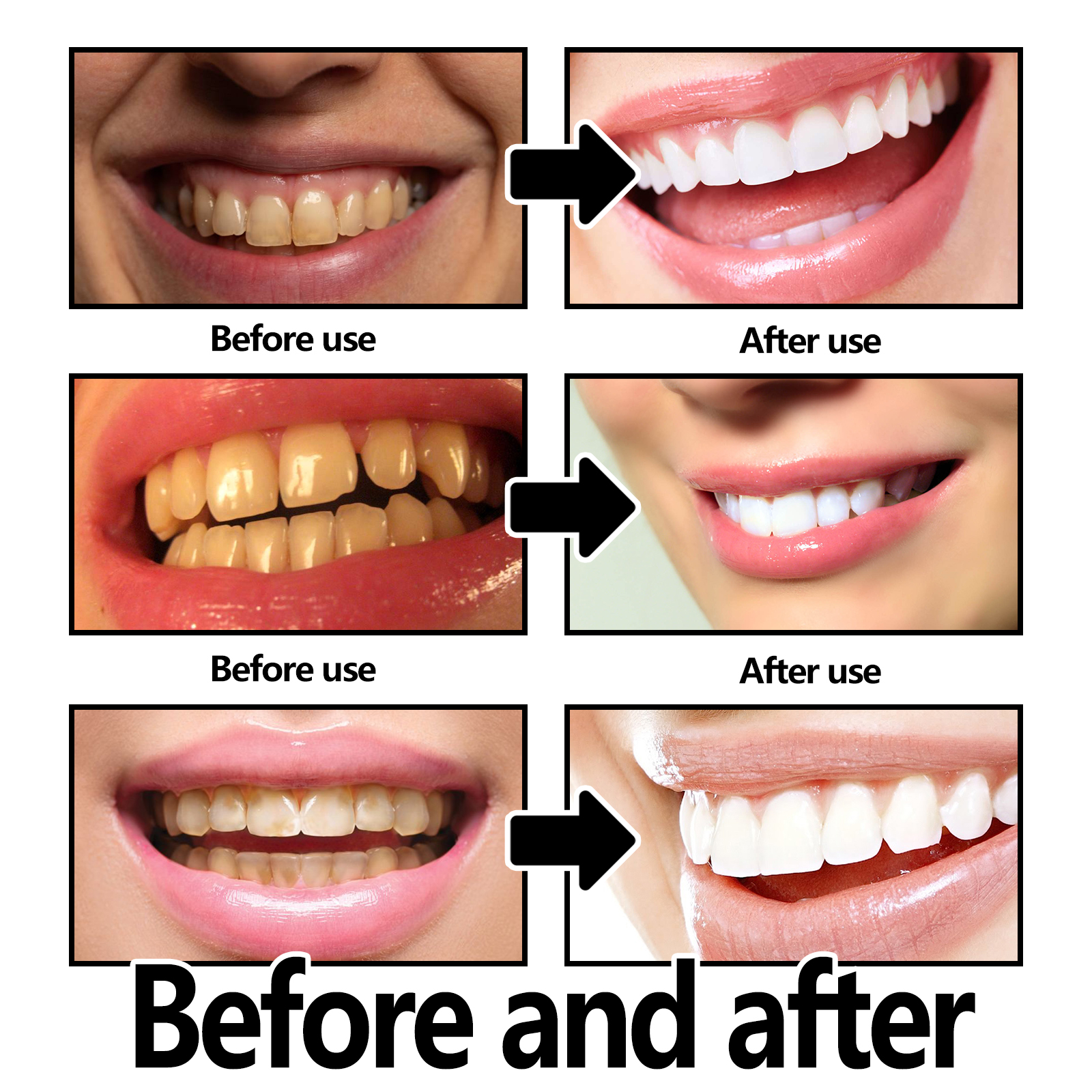 Xylitol Mint Purple Toothpaste - Teeth Whitening Xylitol 리뷰 및 가격