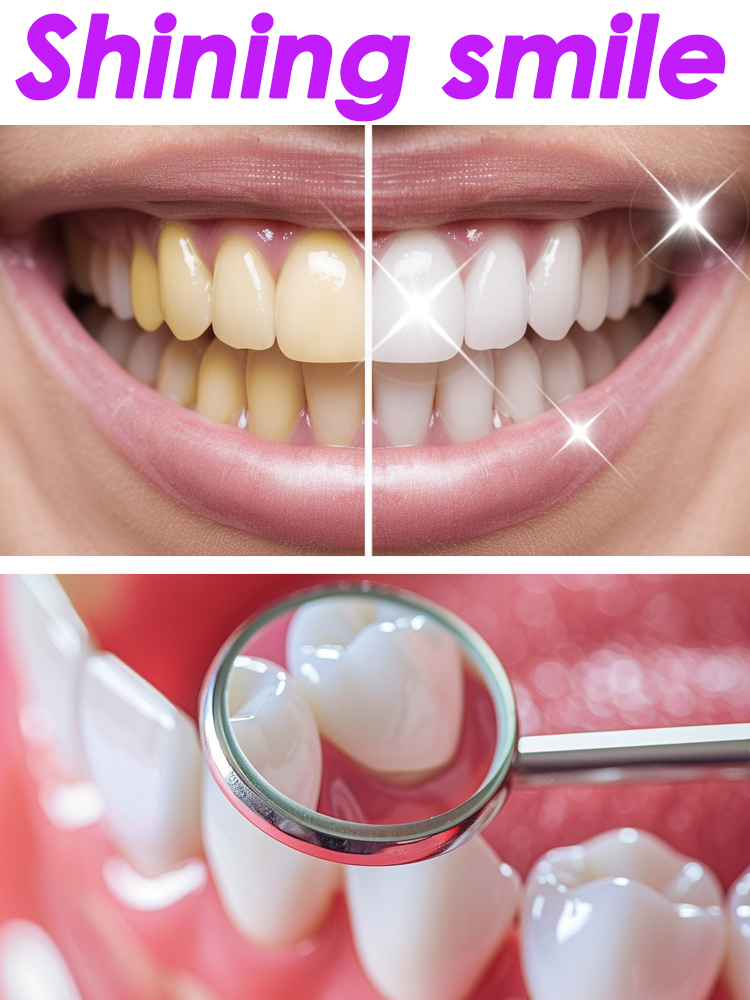 GlorySmile Teeth Whitening Fru - Teeth Whitening Xylitol 리뷰 및 가격
