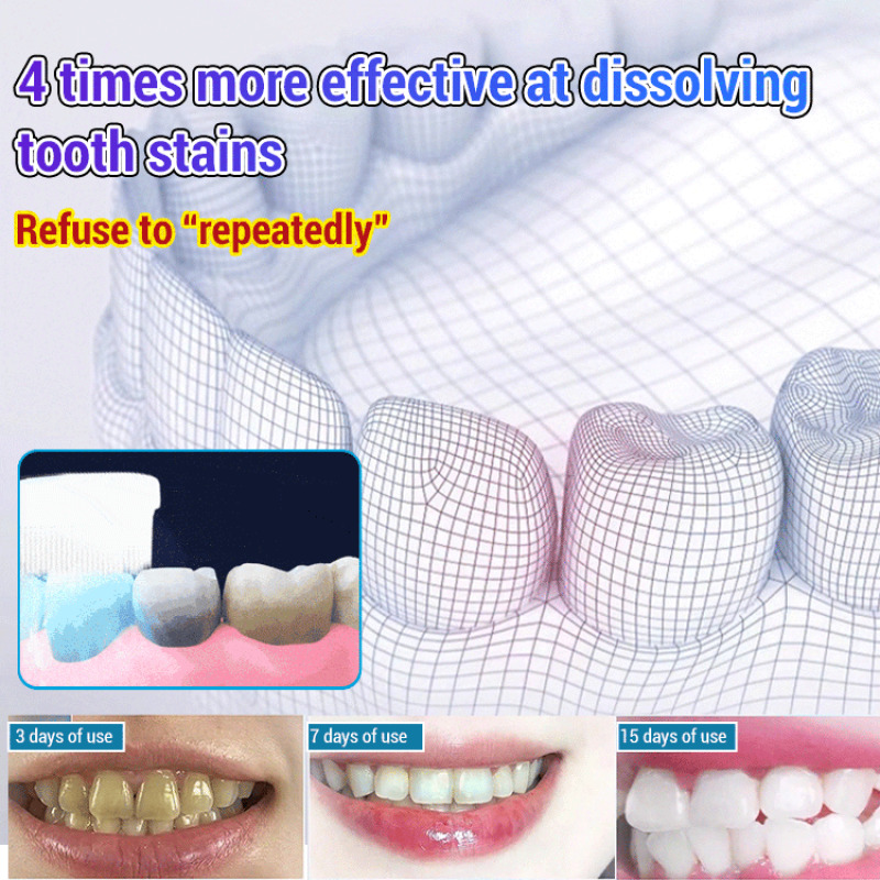 Baking Soda Whiten Teeth Fresh - Teeth Whitening Baking Soda 리뷰 및 가격