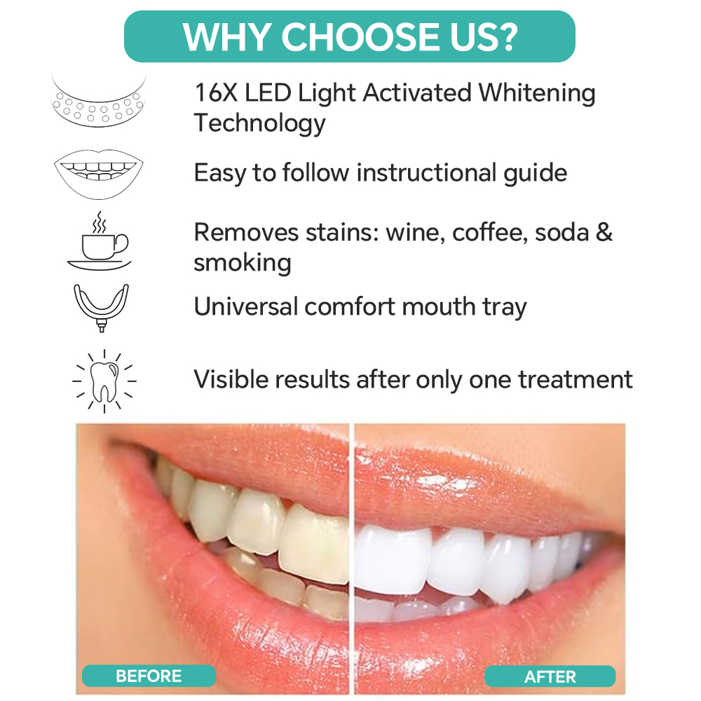 Teeth Whitening Accelerator Li - Teeth Whitening With Blue Light 리뷰 및 가격