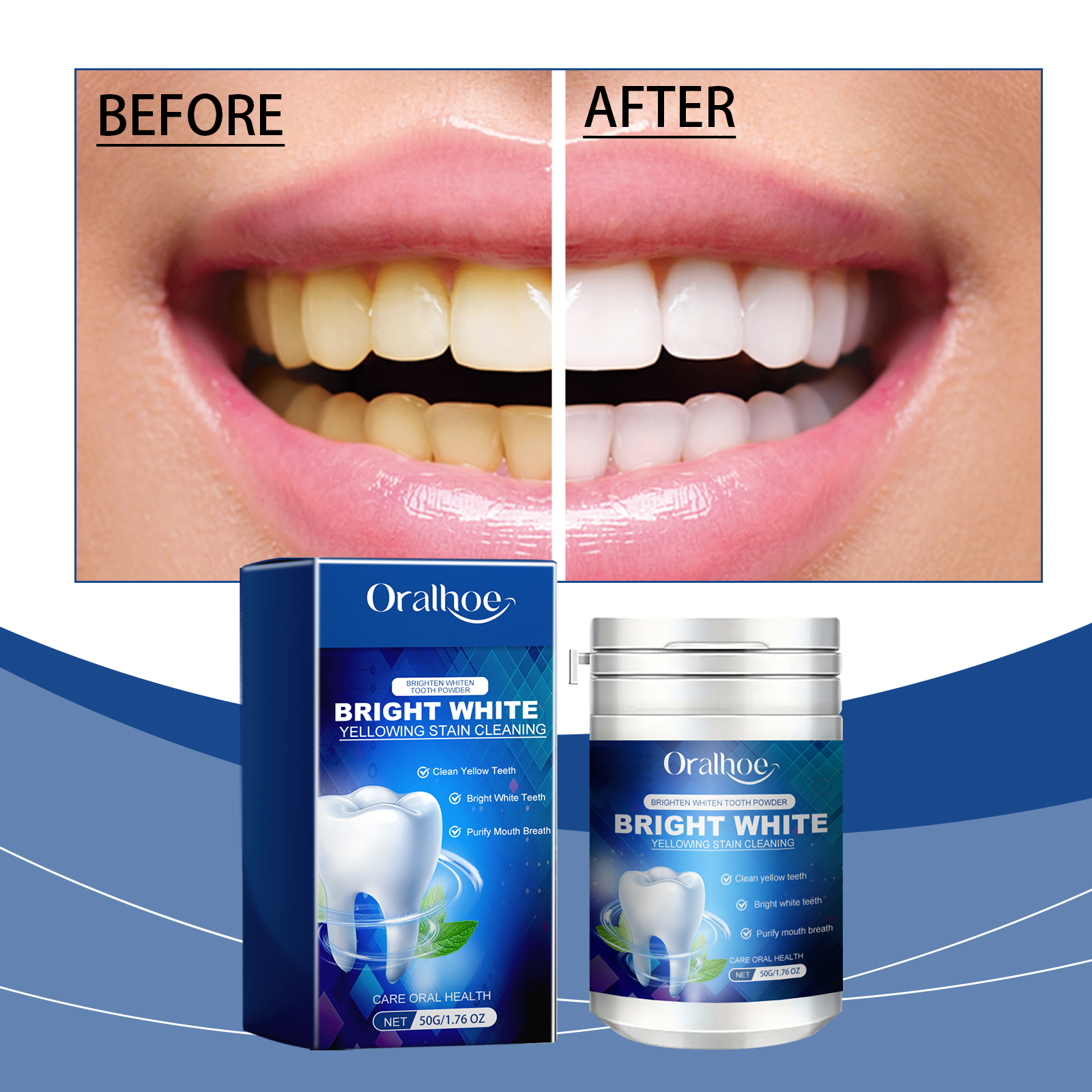 Mint Xylitol Teeth Restoration - Teeth Whitening Xylitol 리뷰 및 가격