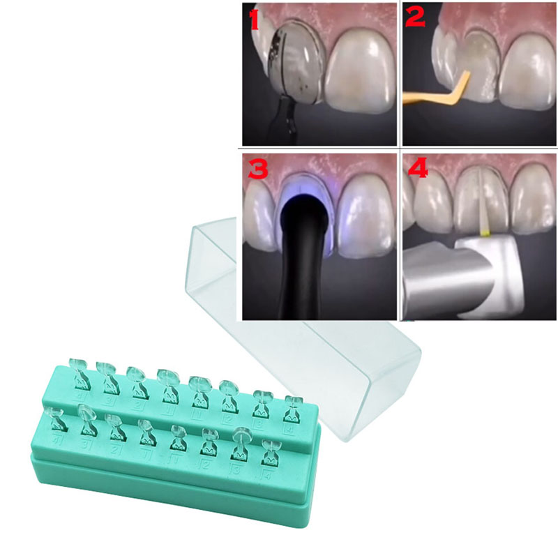 32Pcs Dental Veneer Mould Kit  - Teeth Whitening Moulds 리뷰 및 가격
