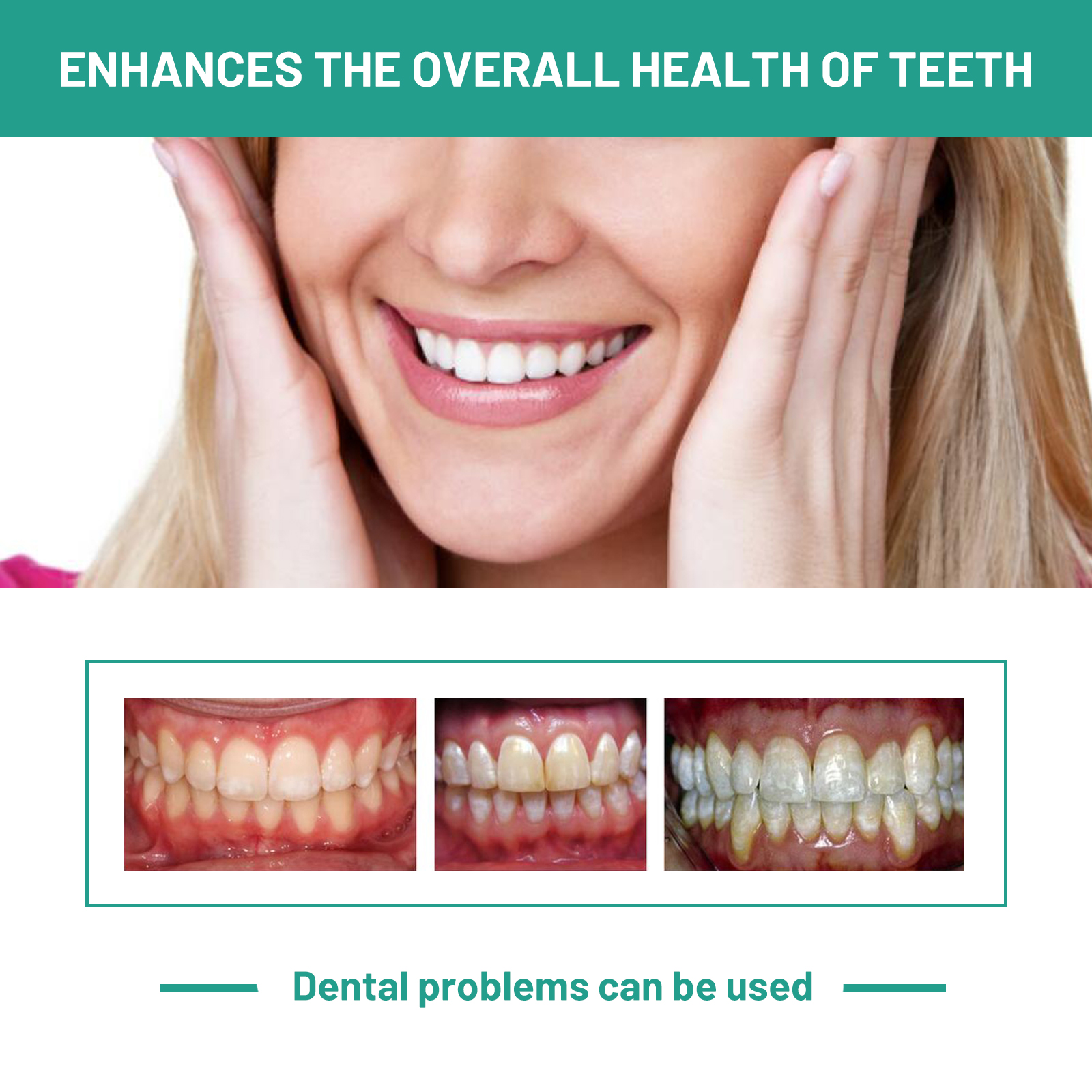 Probiotic Toothpaste Whiten To - Teeth Whitening Xylitol 리뷰 및 가격