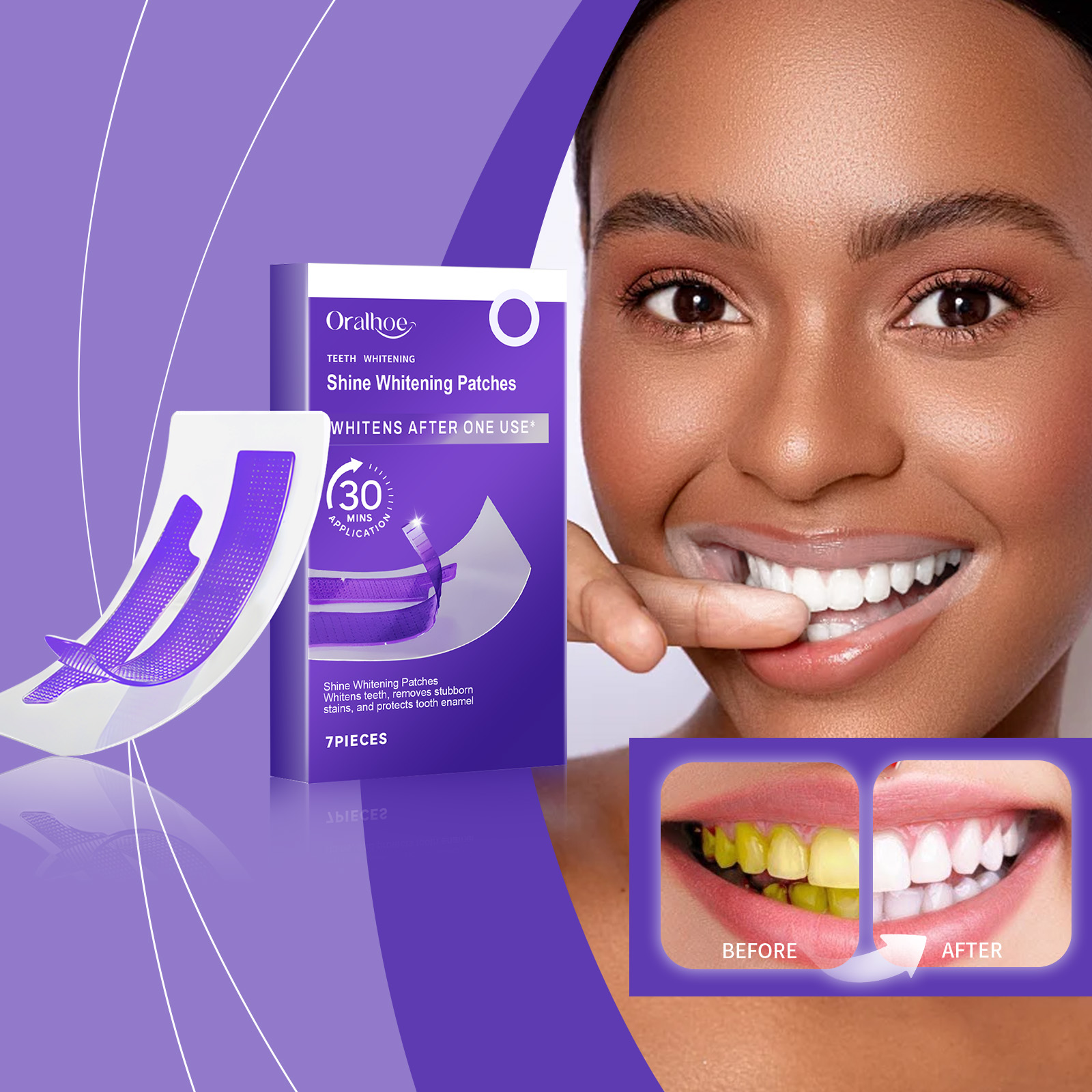 Purple Teeth Whitening Strips  - Teeth Whitening Flash 리뷰 및 가격