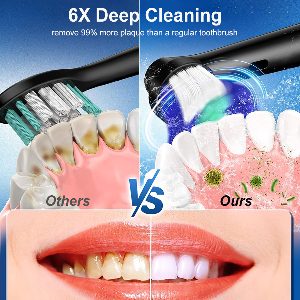 Electric Toothbrush Rotary Rec - Teeth Whitening Toothbrush 리뷰 및 가격