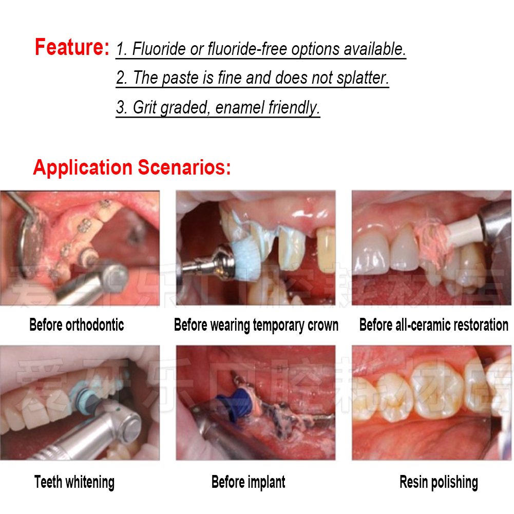 Ivoclar Vivadent Oral Teeth Po - Teeth Whitening Xylitol 리뷰 및 가격