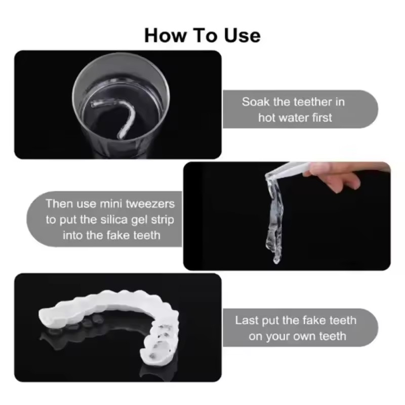 Teeth Veneers Whitening Dentur - Teeth Whitening With Braces 리뷰 및 가격