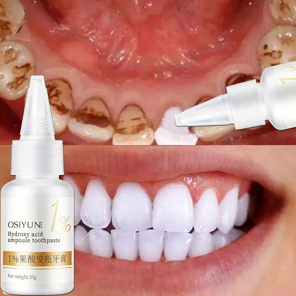 Teeth Whitening Toothpaste Fru - Teeth Whitening Xylitol 리뷰 및 가격