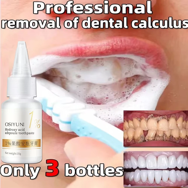 Teeth Whitening Toothpaste Fru - Teeth Whitening Xylitol 리뷰 및 가격