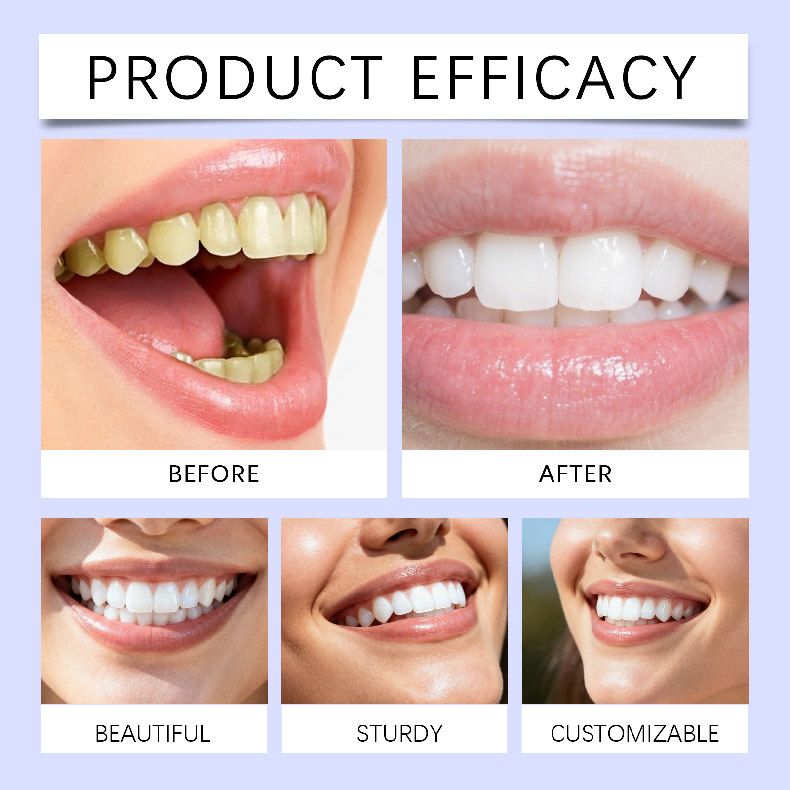 Purple Teeth Whitening Strips  - Teeth Whitening Gel Refills 리뷰 및 가격