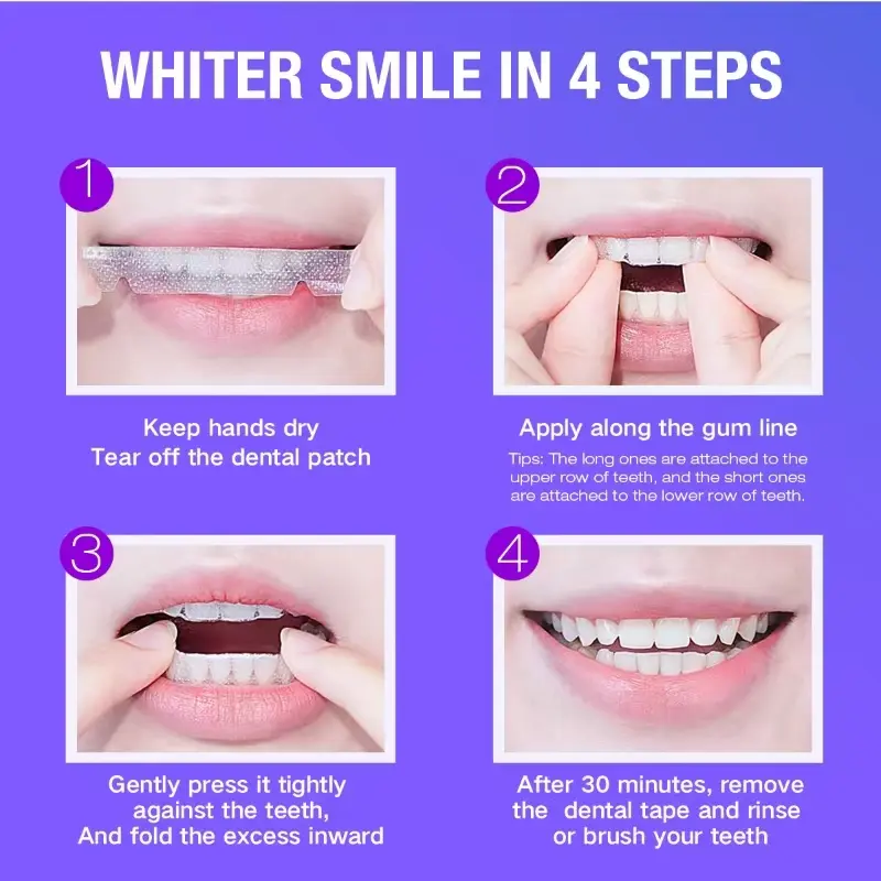 Teeth Whitening Kit - 5X LED L - Teeth Whitening Gel Refills 리뷰 및 가격