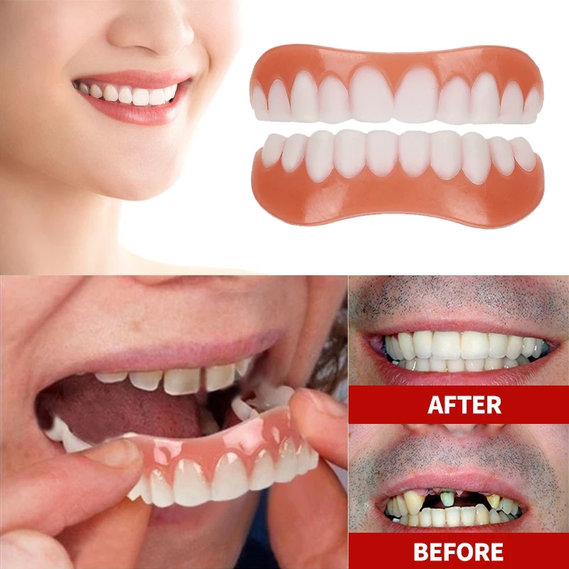 New Denture Silicone Kit Dentu - Teeth Whitening With Braces 리뷰 및 가격