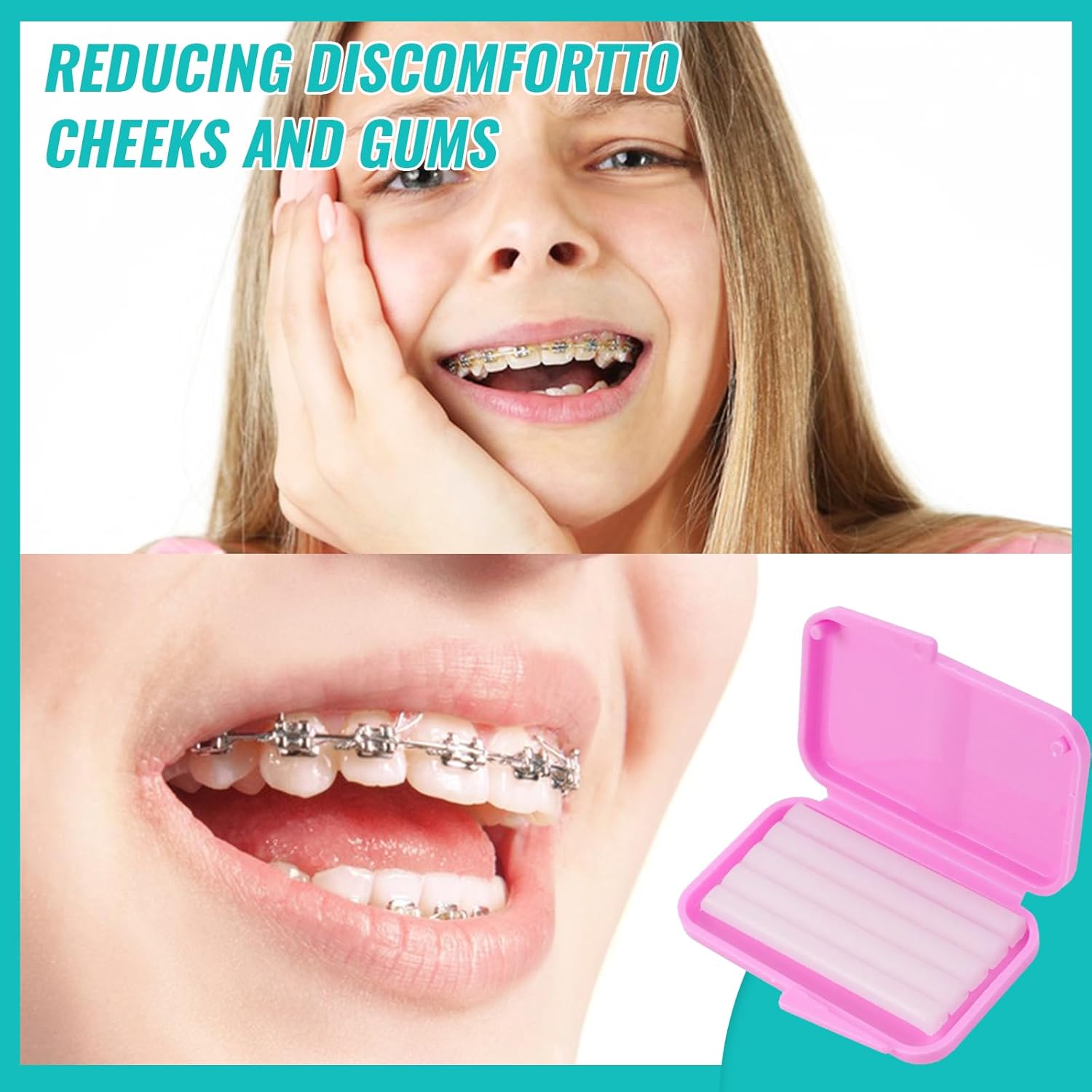 10box Dental Orthodontic Relie - Teeth Whitening With Braces 리뷰 및 가격