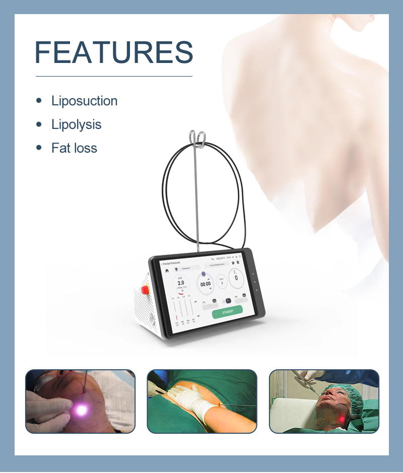 Dental Laser Teeth Whitening D - Teeth Whitening With Laser 리뷰 및 가격
