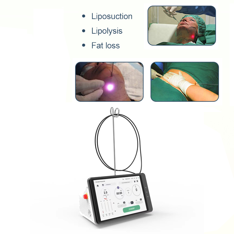 Dental Laser Teeth Whitening D - Teeth Whitening With Laser 리뷰 및 가격