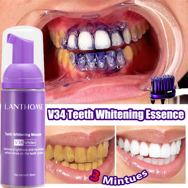 V34 Teeth Whitening Mousse Too - Teeth Whitening Xylitol 리뷰 및 가격