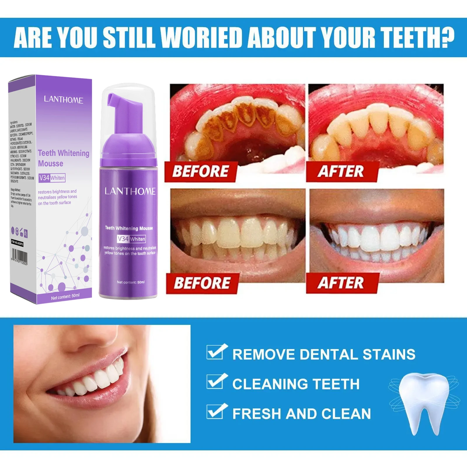 V34 Teeth Whitening Mousse Too - Teeth Whitening Xylitol 리뷰 및 가격