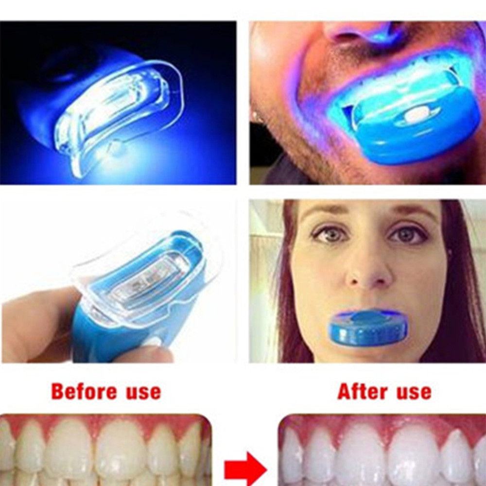 New Blue Led Teeth Whitening A - Teeth Whitening With Laser 리뷰 및 가격