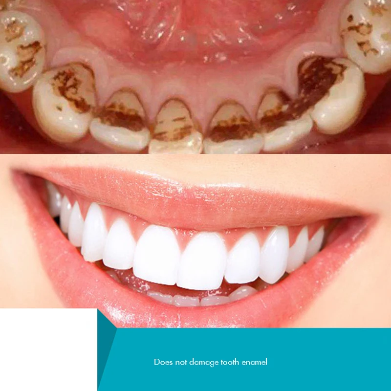 Herbal Tooth Powder, Natural T - Teeth Whitening Xylitol 리뷰 및 가격