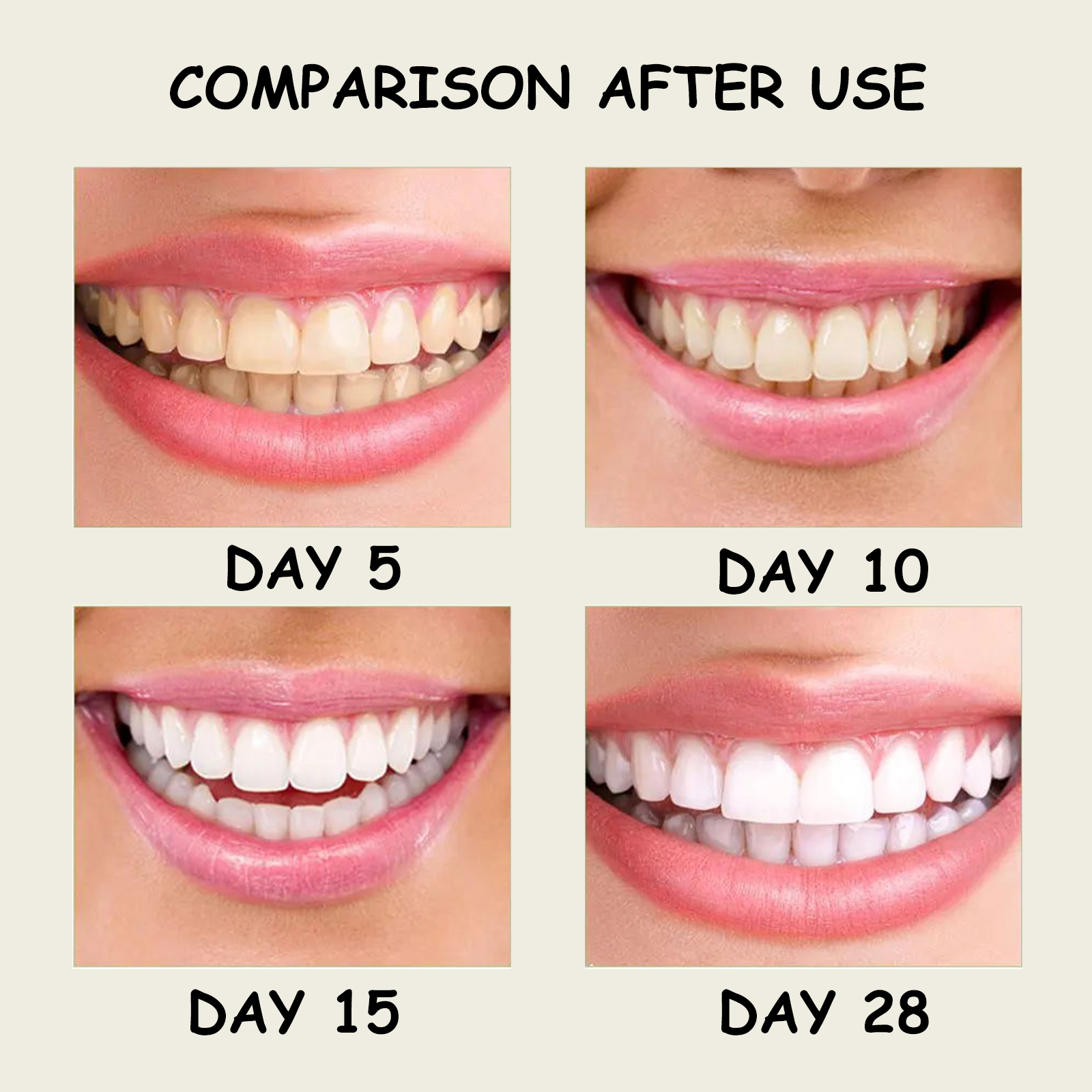 Xylitol Mint Toothpaste Teeth  - Teeth Whitening Xylitol 리뷰 및 가격