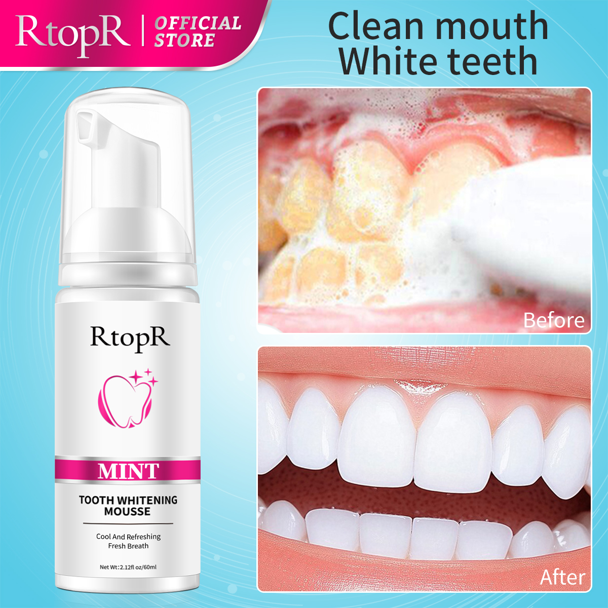RtopR Mint Whitening Teeth Mou - Teeth Whitening Xylitol 리뷰 및 가격