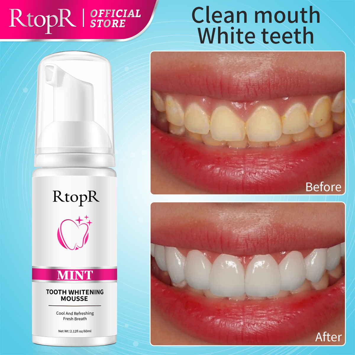 RtopR Mint Whitening Teeth Mou - Teeth Whitening Xylitol 리뷰 및 가격