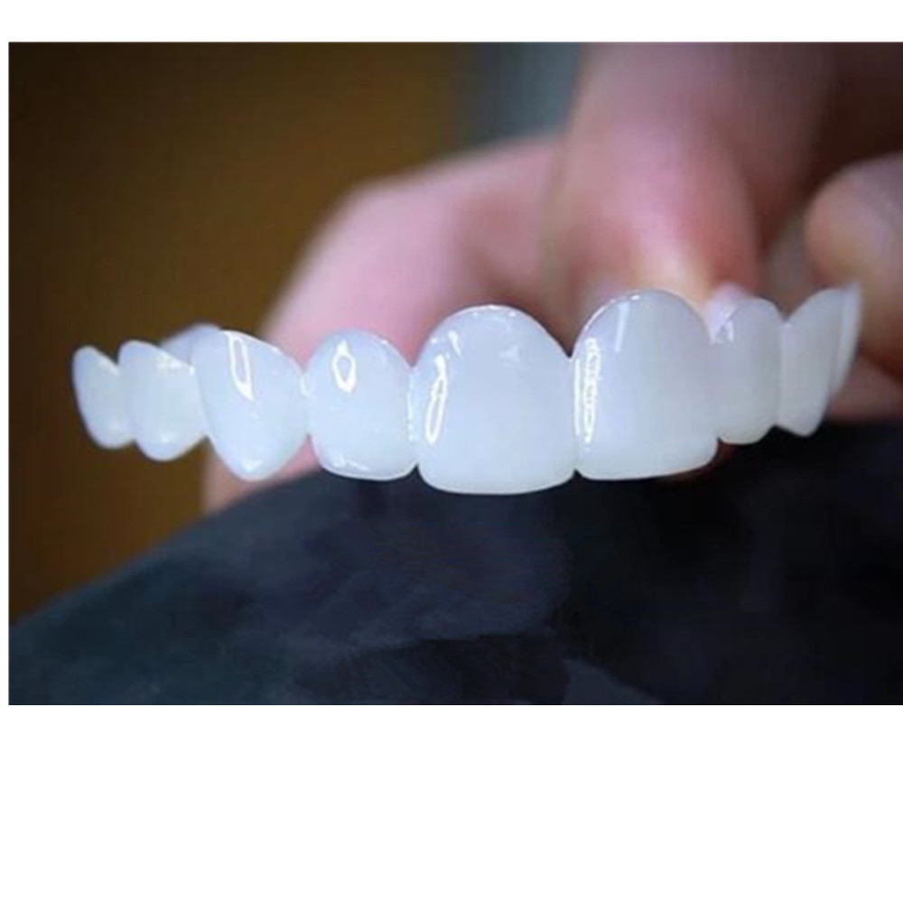 Whitening Teeth Veneers Tempor - Teeth Whitening With Braces 리뷰 및 가격