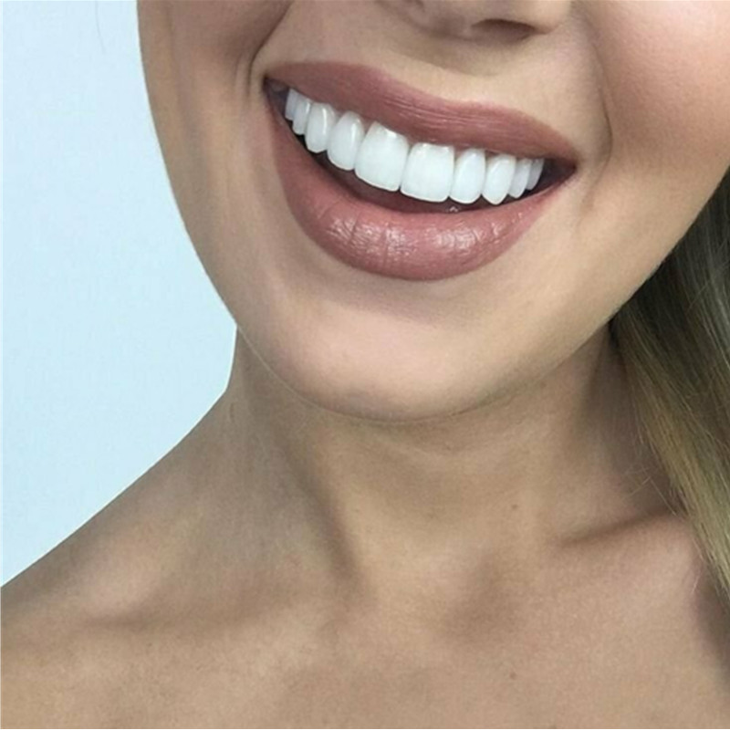 Whitening Teeth Veneers Tempor - Teeth Whitening With Braces 리뷰 및 가격