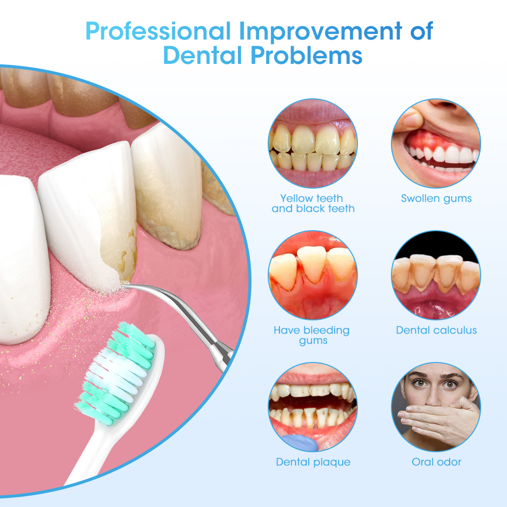 Electric Teeth Cleaner Sonic D - Teeth Whitening Toothbrush 리뷰 및 가격