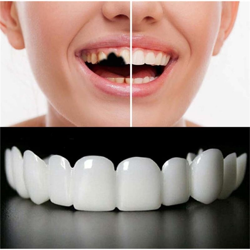 [NEW!ABMK】 2 Pairs,Regain Beau - Teeth Whitening With Braces 리뷰 및 가격