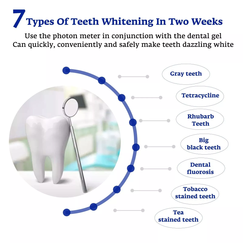 Teeth Whitening Accelerator Sm - Teeth Whitening With Blue Light 리뷰 및 가격